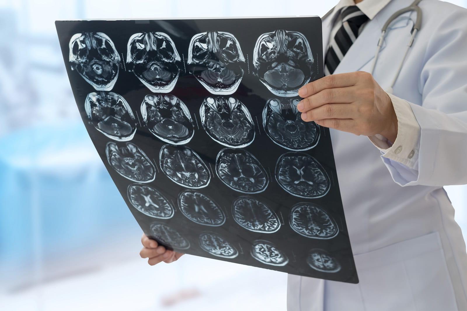 doctor viewing brain scan